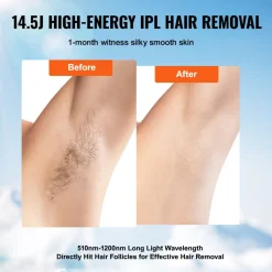 VEVOR IPL Hair Removal, Permanent Hair Removal with Sapphire Ice Cooling System, Painless At-Home Hair Removal Device for Women Men, Auto/Manual Modes, 5 Levels for Body & Face